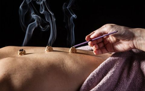 Image for 3. Moxibustion